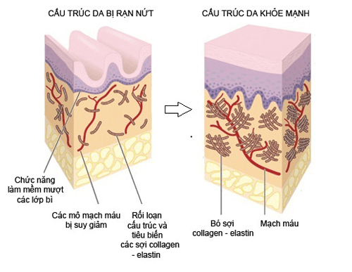 Trẻ hóa da bằng công nghệ Nano Collagen