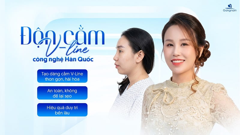 Độn cằm V-Line là gì? Có vĩnh viễn không? 7 Độn cằm V-line