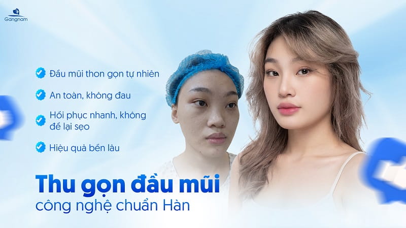 Thu nhỏ đầu mũi - Tạo dáng mũi cân đối, hài hòa với gương mặt 9 Thu nhỏ đầu mũi