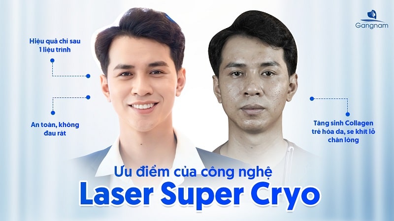 Điều trị sẹo rỗ công nghệ Laser Super Cryo 5 Điều trị sẹo rỗ công nghệ Laser Super Cryo