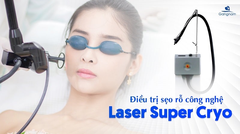 Điều trị sẹo rỗ công nghệ Laser Super Cryo 4 Điều trị sẹo rỗ công nghệ Laser Super Cryo