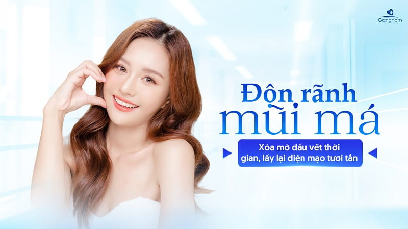 Độn rãnh mũi má - Xóa mờ dấu vết thời gian, lấy lại diện mạo tươi tắn 5 Độn rãnh mũi má