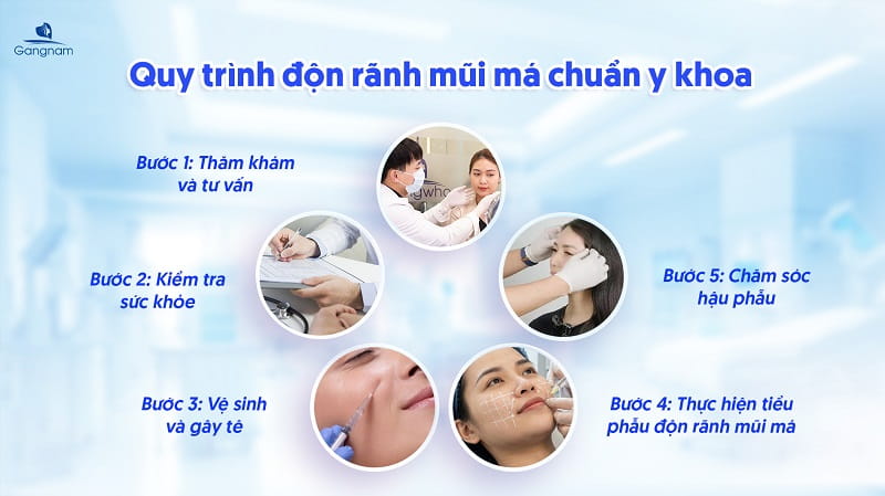 Độn rãnh mũi má - Xóa mờ dấu vết thời gian, lấy lại diện mạo tươi tắn 7 Độn rãnh mũi má