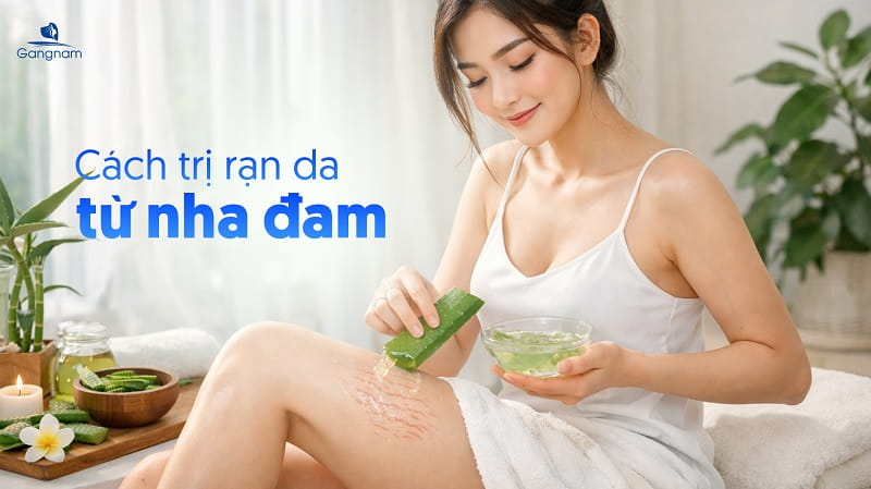 Top 5 cách trị rạn da hiệu quả từ nguyên liệu thiên nhiên 5 Cách trị rạn da