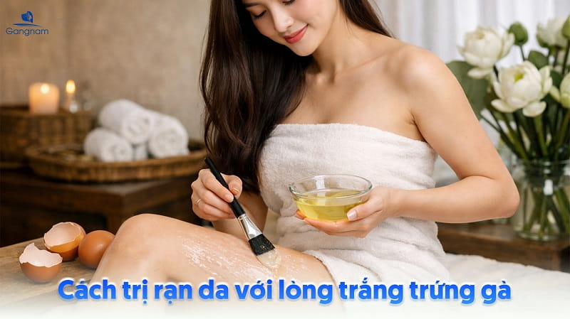 Top 5 cách trị rạn da hiệu quả từ nguyên liệu thiên nhiên 6 Cách trị rạn da