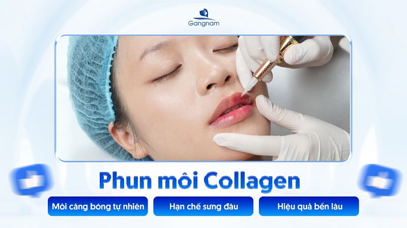 Phun môi Collagen là gì? Có nên phun môi Collagen không? 6 Phun môi Collagen