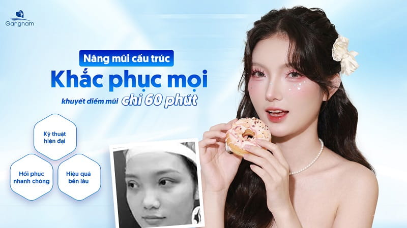 Dáng mũi hếch là gì? Có nên sửa mũi hếch không? 8 Mũi hếch là gì?