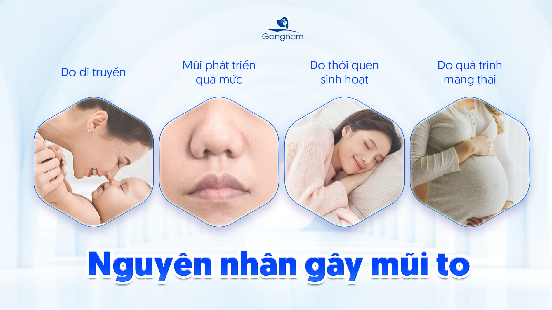 Mũi to là như thế nào? Tướng mũi to tốt hay xấu? 7 Mũi to là như thế nào?
