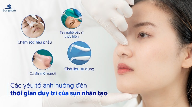 Nâng mũi sụn nhân tạo có vĩnh viễn không?