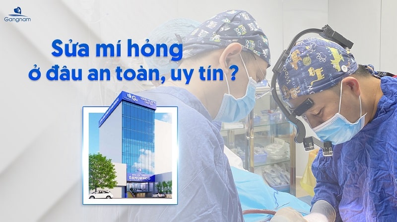 Sửa mí hỏng ở đâu?