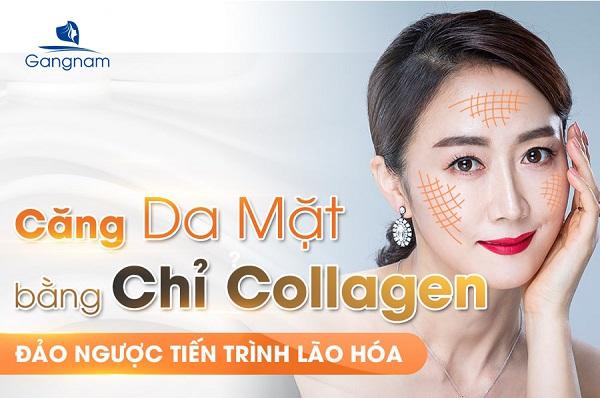 Căng da mặt bằng chỉ collagen giữ được bao lâu?