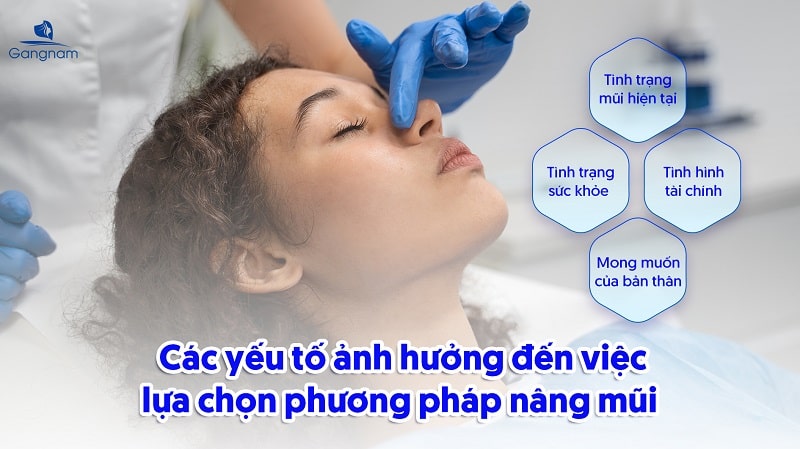 Nên nâng mũi cấu trúc hay bọc sụn? 7 Nâng mũi cấu trúc hay bọc sụn
