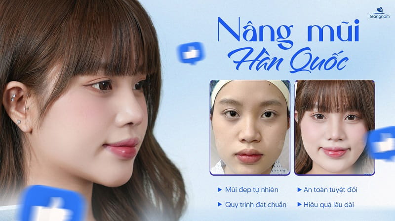 Quy trình nâng mũi Hàn Quốc đạt chuẩn diễn ra như thế nào? 6 Quy trình nâng mũi Hàn Quốc