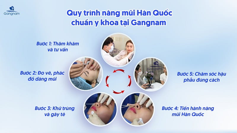 Quy trình nâng mũi Hàn Quốc đạt chuẩn diễn ra như thế nào? 7 Quy trình nâng mũi Hàn Quốc
