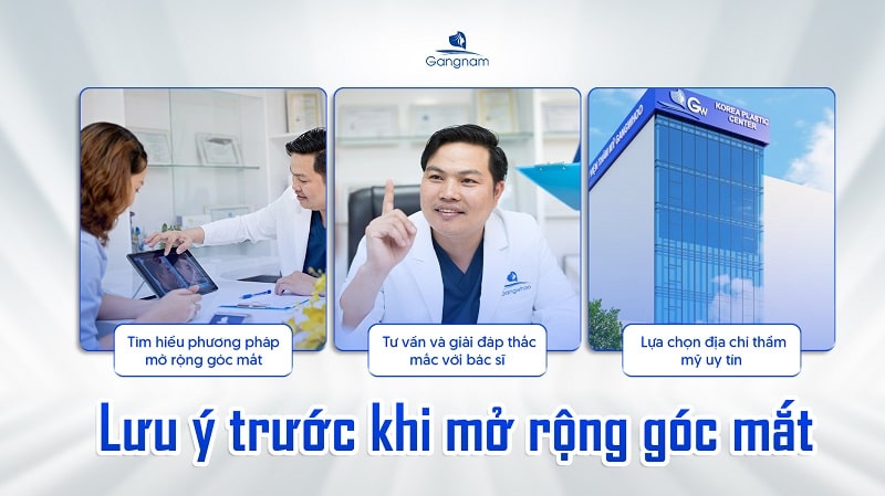Lưu ý khi mở rộng góc mắt