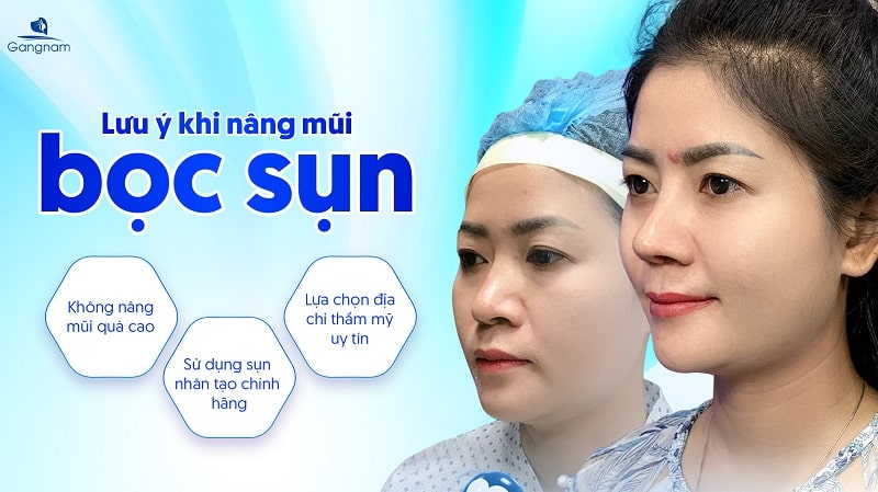 Trường hợp nào nên nâng mũi bọc sụn? 7 Trường hợp nào nên nâng mũi bọc sụn?