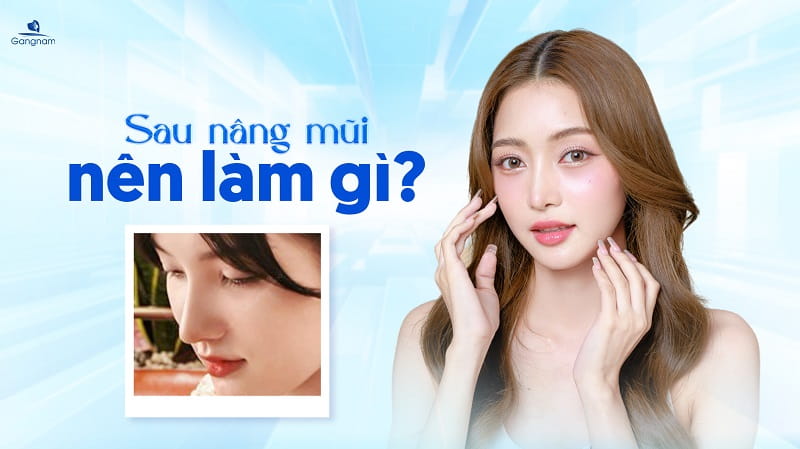 Sau nâng mũi nên làm gì? 5 Sau nâng mũi nên làm gì?