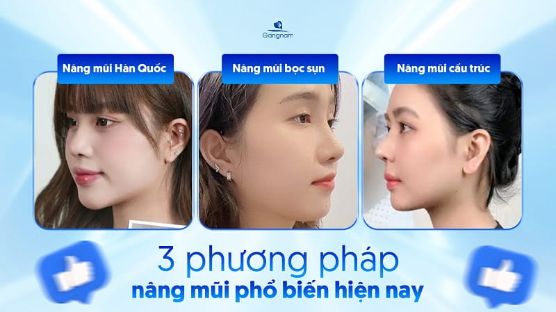 Sau nâng mũi nên làm gì? 6 Sau nâng mũi nên làm gì?