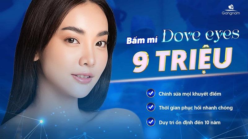 Bấm mí mắt là gì? Giữ được bao lâu? 13 Bấm mí mắt là gì