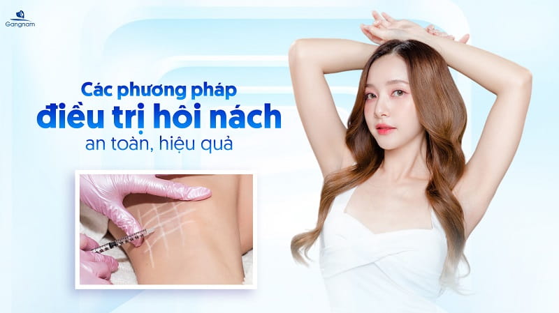 Các phương pháp điều trị hôi nách an toàn, hiệu quả 5 Điều trị hôi nách