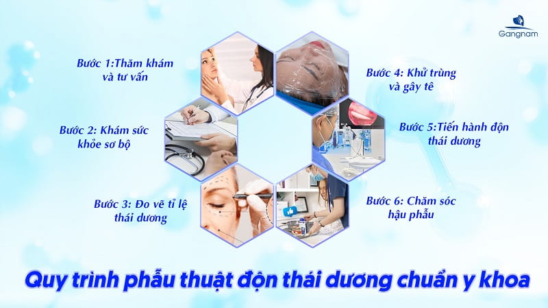 Độn thái dương là gì? Các phương pháp làm đầy thái dương phổ biến hiện nay 8 Độn thái dương