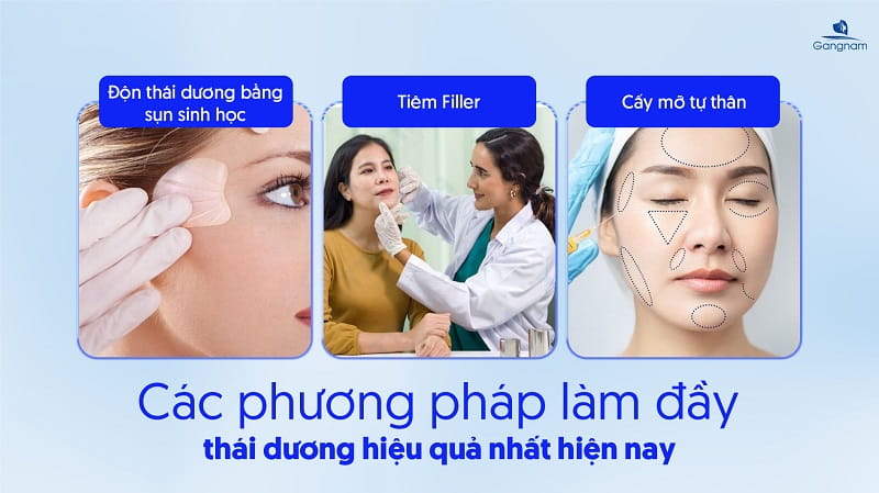 Độn thái dương là gì? Các phương pháp làm đầy thái dương phổ biến hiện nay 7 Độn thái dương