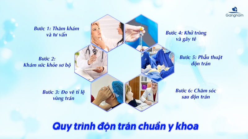 Độn trán là gì? Các phương pháp độn trán phổ biến hiện nay 8 Độn trán là gì?