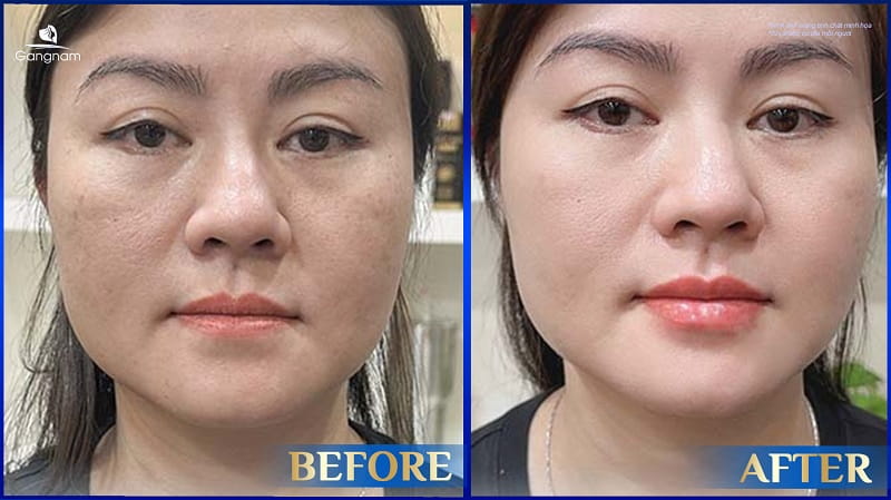 Tạo hình môi trái tim - Nâng tầm vẻ đẹp quyến rũ cho phái nữ 12 Tạo hình môi trái tim