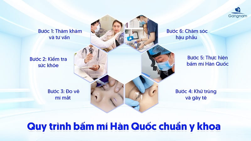 Bấm mí Hàn Quốc - Giải pháp kiến tạo đôi mắt 2 mí to tròn, tự nhiên 9 Bấm mí Hàn Quốc