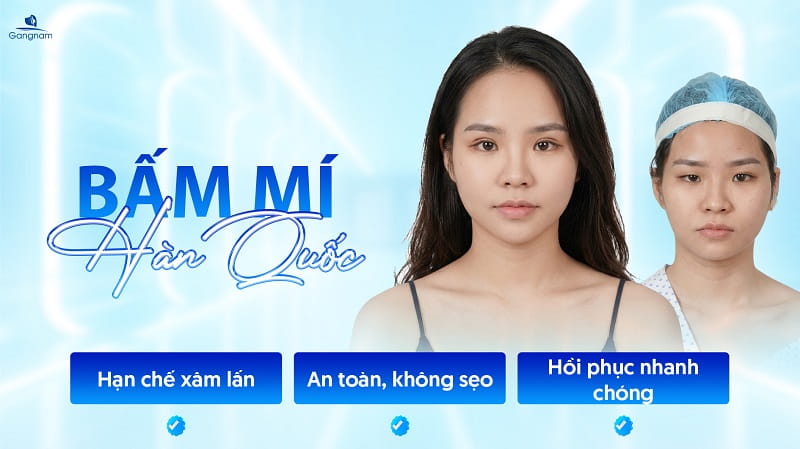 Bấm mí Hàn Quốc - Giải pháp kiến tạo đôi mắt 2 mí to tròn, tự nhiên 12 Bấm mí Hàn Quốc