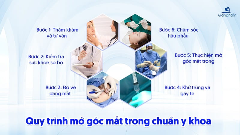 Mở góc mắt trong Mini - Đôi mắt to tròn, thu hút mọi ánh nhìn 9 Mở góc mắt trong
