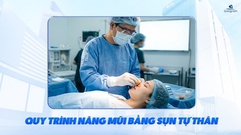 Nâng mũi sụn tự thân có tốt không? 9 Nâng mũi sụn tự thân