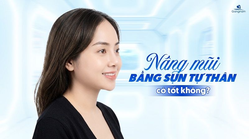 Nâng mũi sụn tự thân có tốt không? 6 Nâng mũi sụn tự thân
