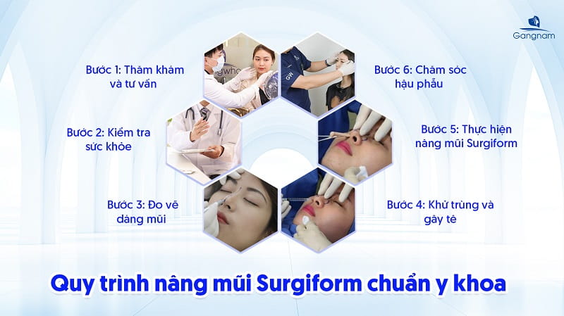 Nâng mũi Surgiform - Giải pháp cho dáng mũi chuẩn đẹp, bền lâu 8 Nâng mũi Surgiform