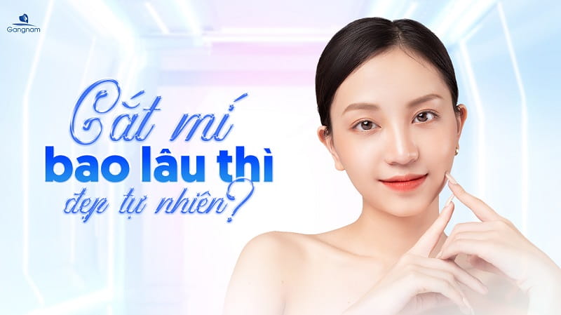 Cắt mí bao lâu thì đẹp tự nhiên? 3 giai đoạn hồi phục sau cắt mí mắt 5 Cắt mí bao lâu thì đẹp tự nhiên?
