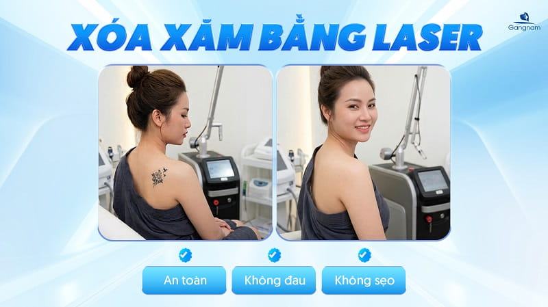 Xóa xăm bằng công nghệ Laser - Hiệu quả rõ rệt chỉ sau 1 liệu trình 8 Xóa xăm bằng công nghệ Laser