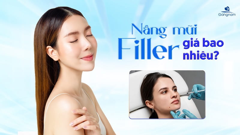 Nâng mũi Filler giá bao nhiêu? 4 lưu ý quan trọng khi tiêm Filler mũi 5 Nâng mũi Filler giá bao nhiêu?