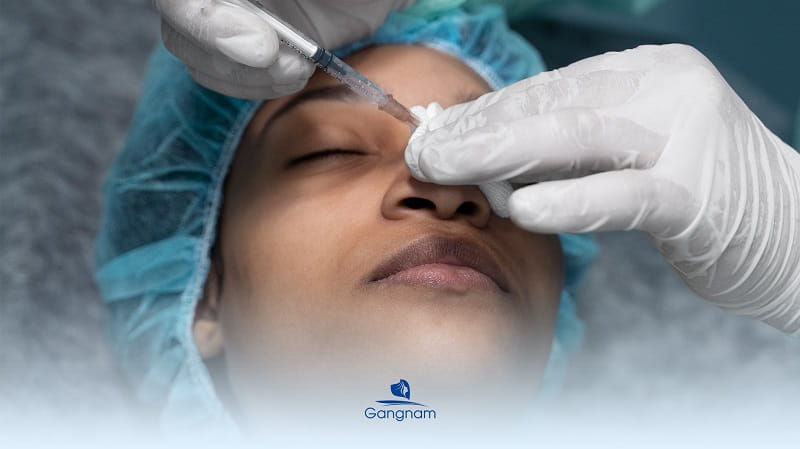 Nâng mũi Filler giá bao nhiêu? 4 lưu ý quan trọng khi tiêm Filler mũi 6 Nâng mũi Filler giá bao nhiêu?