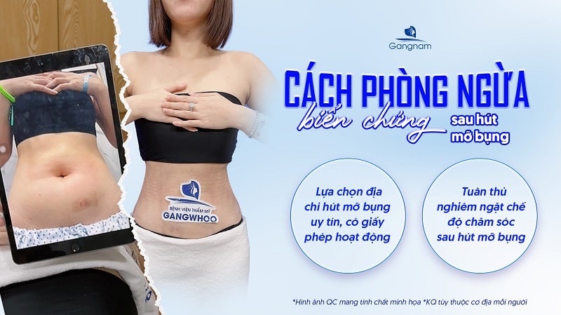 Hút mỡ bụng có nguy hiểm không? 2 giải pháp phòng ngừa biến chứng khi hút mỡ bụng 7 Giảm mỡ