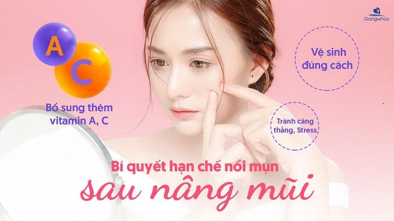 Nâng mũi có nặn mụn được không? 7 Nâng mũi có nặn mụn được không?