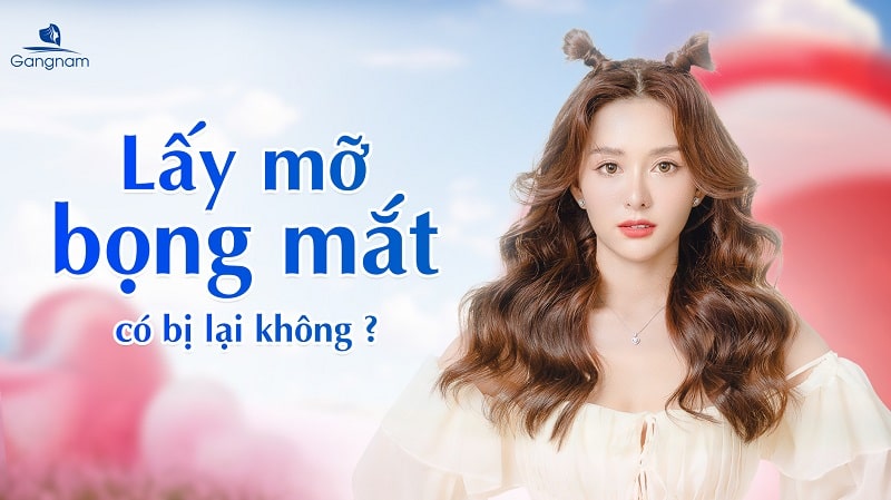 Lấy mỡ bọng mắt có bị lại không?