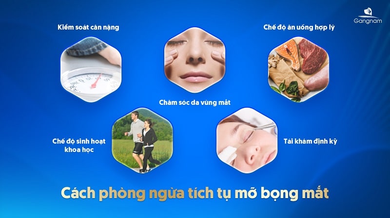 Lấy mỡ bọng mắt có bị lại không?