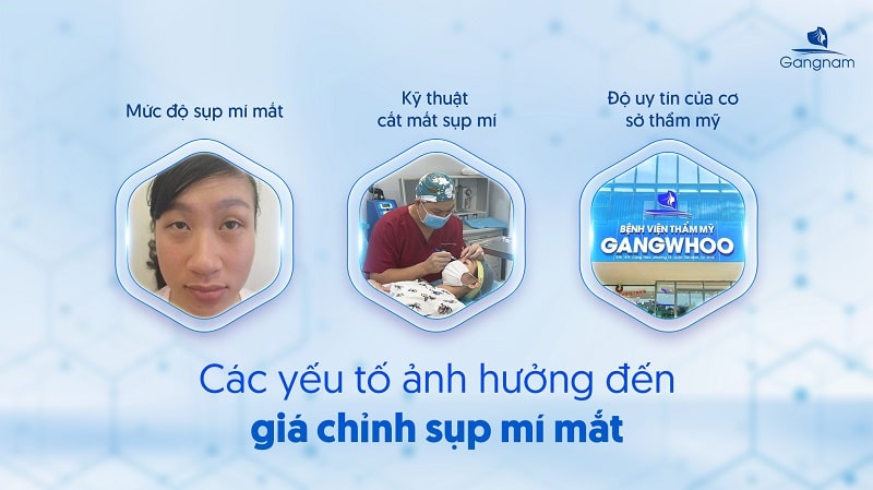 Cắt mắt sụp mí bao nhiêu tiền?