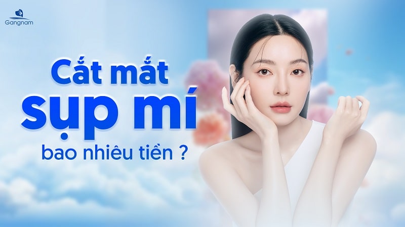 Cắt mắt sụp mí bao nhiêu tiền?