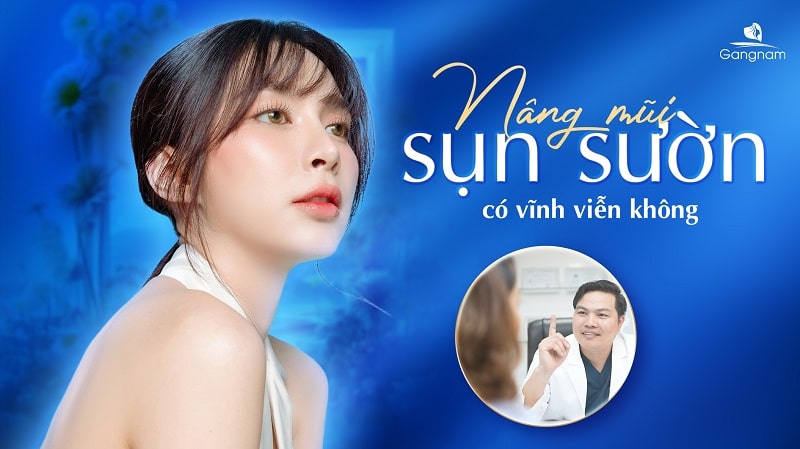 Nâng mũi sụn sườn có vĩnh viễn không?