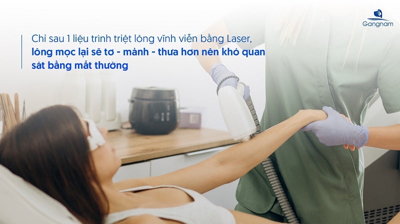 Triệt lông vĩnh viễn có mọc lại không?