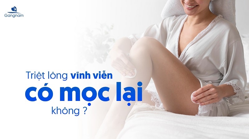 Triệt lông vĩnh viễn có mọc lại không?