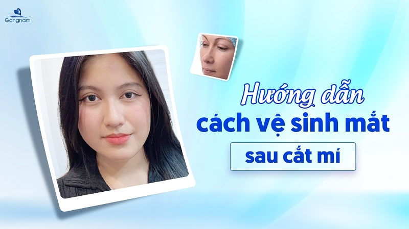 Hướng dẫn cách vệ sinh mắt sau khi cắt mí 5 Cách vệ sinh mắt sau khi cắt mí