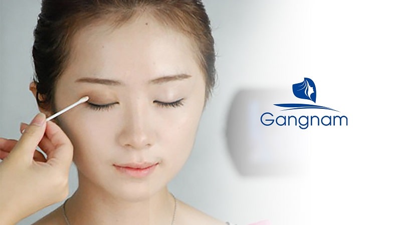 Hướng dẫn cách vệ sinh mắt sau khi cắt mí 6 Cách vệ sinh mắt sau khi cắt mí