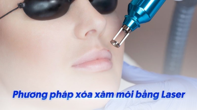 Phun môi bị lem viền - Nguyên nhân và cách khắc phục hiệu quả 7 Phun môi bị lem viền